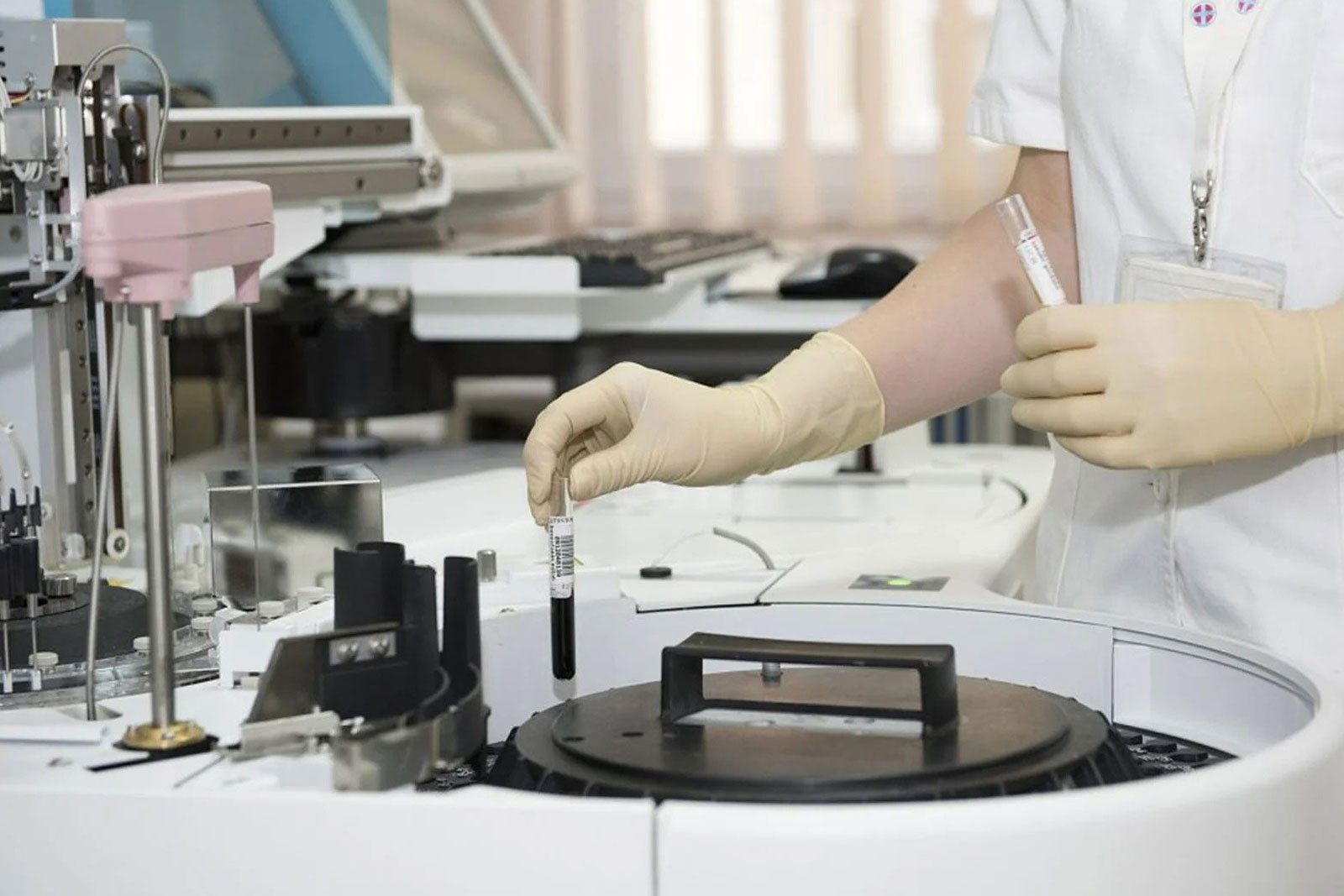 Upvita-Laktoferrin-Takviye-Edici-Gıda